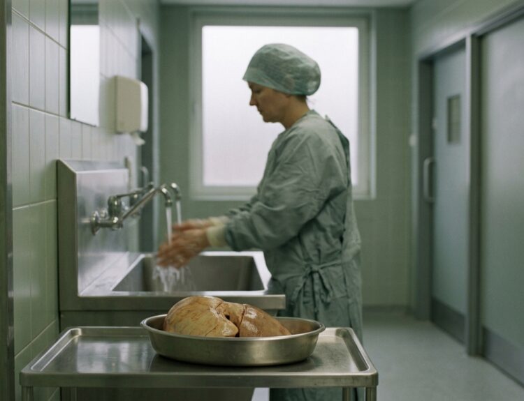TALENTOP Proved Conversion Surgery Works in Advanced HCC. Now Comes the Harder Question.