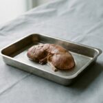 When Payer Status Becomes a Protocol Variable: What the Medicare Advantage Transplant Gap Means for ESKD Trial Enrollment